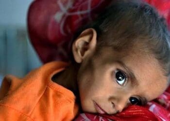 روز جهانی تغذیه؛ دبلیو‌اف‌پی می‌گوید حدود سه میلیون کودک در افغانستان به سوء تغذیه مبتلا هستند