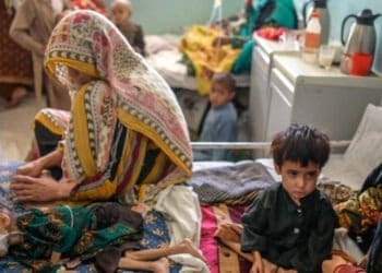 اوچا می‌گوید سو‌‌ءتغدیه‌ی حاد میان کودکان افغانستان درحال افزایش است