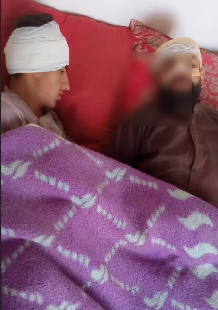 پسر یک فرمانده طالبان شش تن را در تخار زخمی کرد