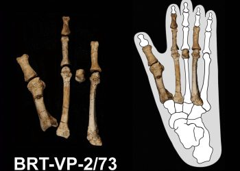دانشمندان راز «پای بورتِله» در انسانتباران باستانی را حل کردند